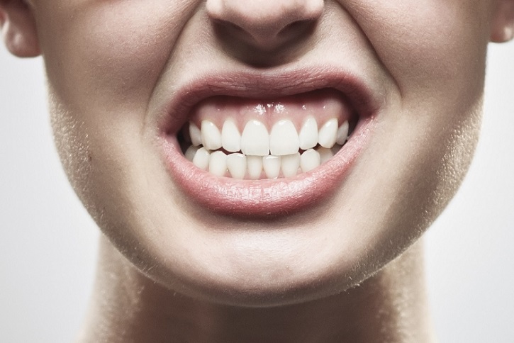 bruxismo-dientes